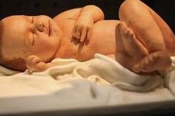 二代试管婴儿是否唐筛和NT风险都比较低？