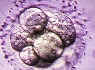 桂平试管婴儿成功多少例？试管婴儿成功秘诀全分享！